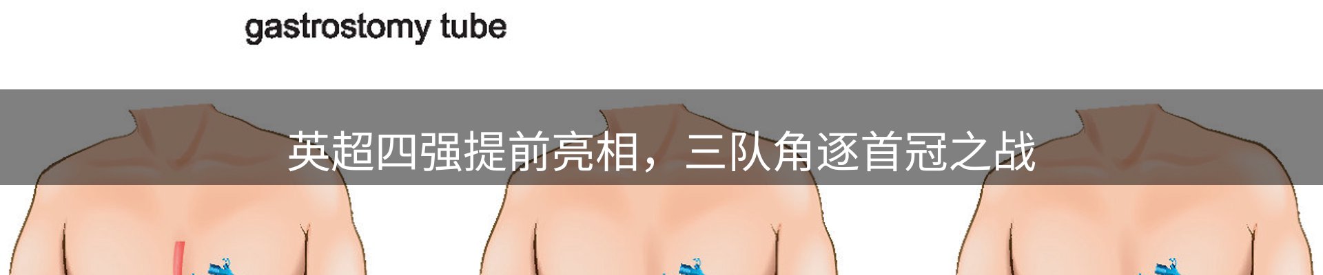 体育资讯